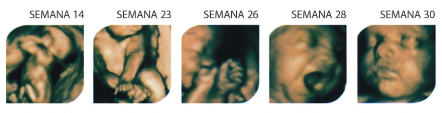 FarmaEstetic Baby – Ecox 4D FarmaEstetic Baby – Ecox 4D