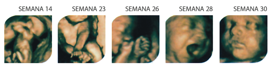 FarmaEstetic Baby – Ecox 4D FarmaEstetic Baby – Ecox 4D